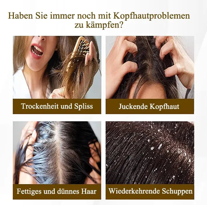 Kopfhautmassage-Kamm – Sanfte Schuppenentfernung & Pflege Mivoza Deutschland