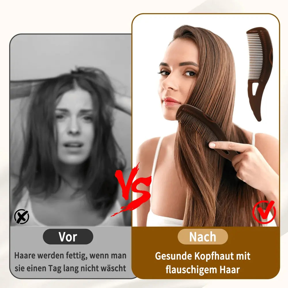 Kopfhautmassage-Kamm – Sanfte Schuppenentfernung & Pflege Mivoza Deutschland
