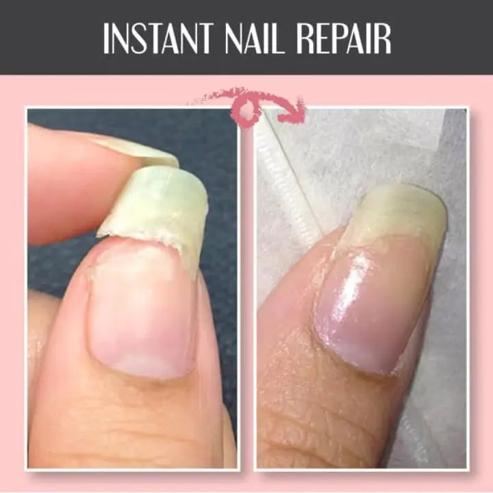 Nagelreparatur-Schutzgel – Schnelle Hilfe für beschädigte Nägel Mivoza Deutschland