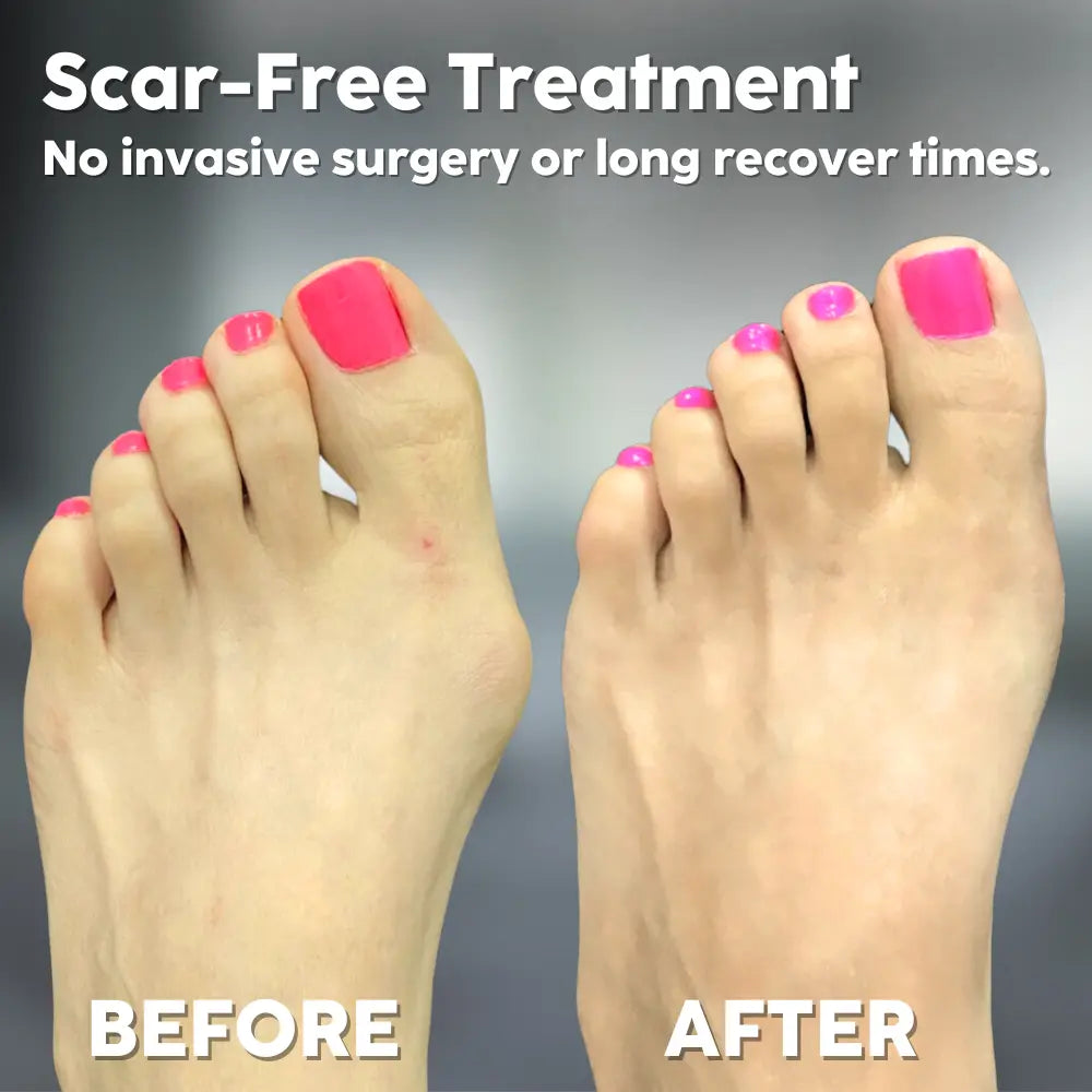 CurePain™ - Orthopedische Baltrainer Mivoza Deutschland