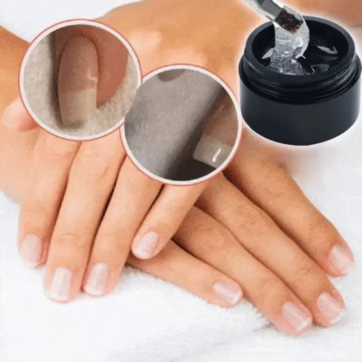 Nagelreparatur-Schutzgel – Schnelle Hilfe für beschädigte Nägel Mivoza Deutschland